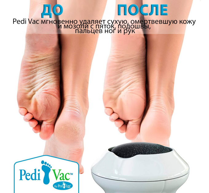 Електрична пемза для ніг Pedi Vac